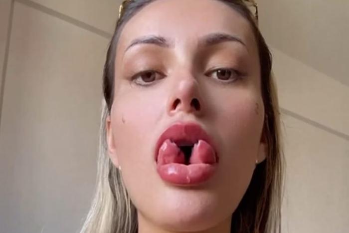 Andressa Urach mostra resultado final de bifurcação na língua: 