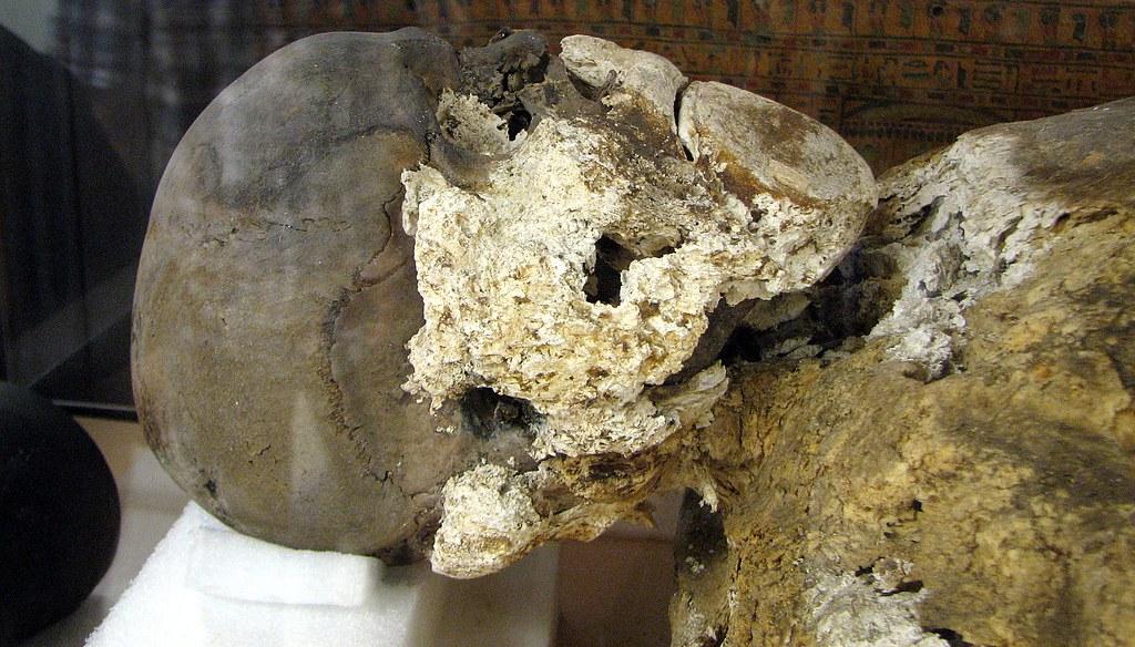 Saponificação: como a natureza preserva corpos após a morte?